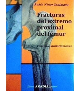 FRACTURAS DEL EXTREMO PROXIMAL DEL F&Eacute;MUR. Estudio Anatomopatol&oacute;gico 9789875702530 Akadia 46,55&nbsp;&euro;