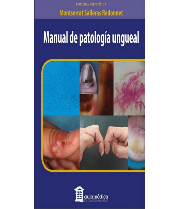 MANUAL DE PATOLOG&Iacute;A UNGUEAL 9788478856244 AULA M&Eacute;DICA 38,95&nbsp;&euro;