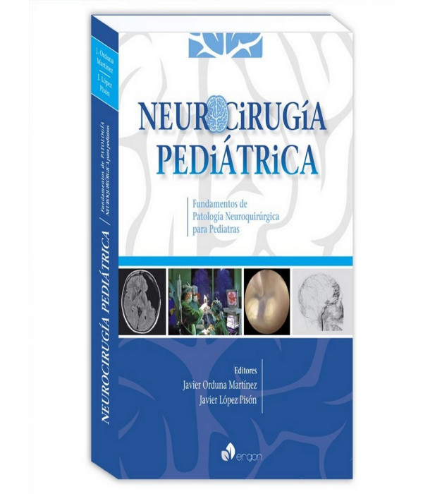 Neurocirugía pediátrica. Fundamentos de patología neuroquirúrgica para pediatras 9788416732616 ERGON 51,30 €