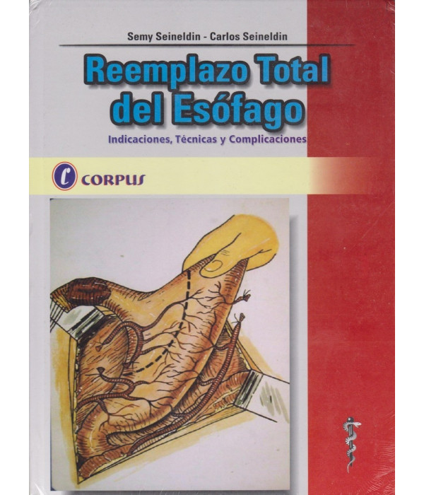 REEMPLAZO TOTAL DEL ES&Oacute;FAGO. 978-987-1860-02-9 CORPUS 64,60&nbsp;&euro;