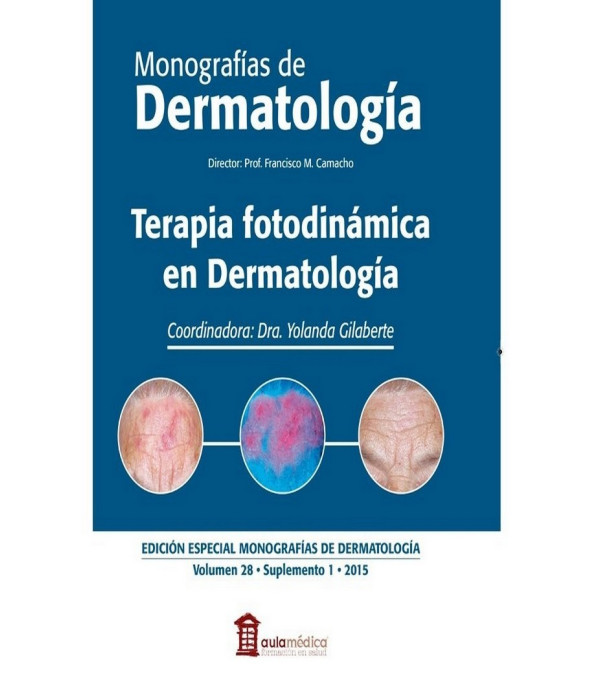 TERAPIA FOTODINÁMICA EN DERMATOLOGÍA. 9788478855834 38,01 €