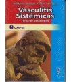 Vasculitis Sistemicas. Toma de Decisiones